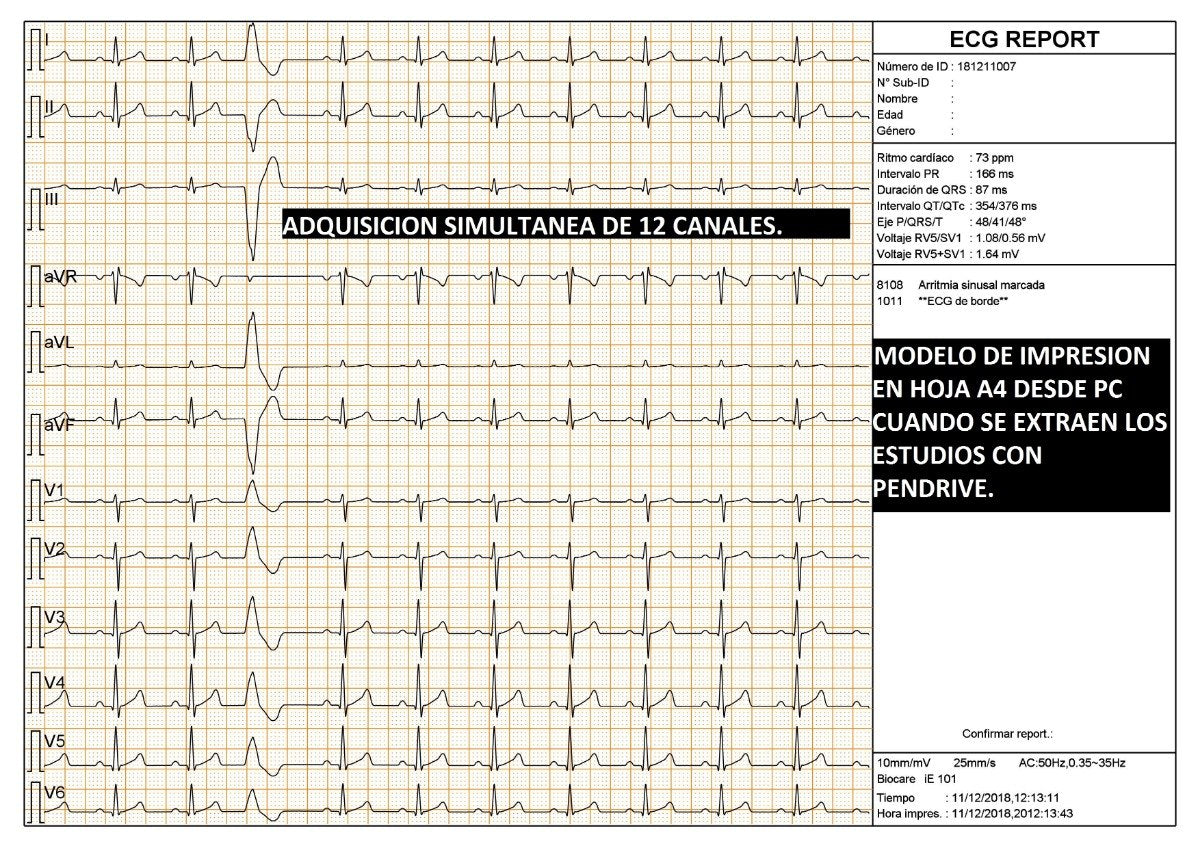 Electrocardiografo Biocare iE300 12 Derivaciones 3 Canales