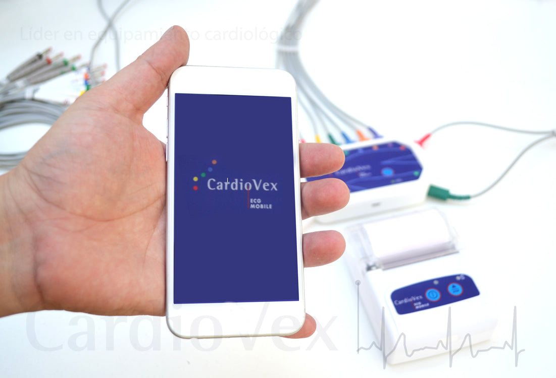 Ecg Mobile Cardiovex